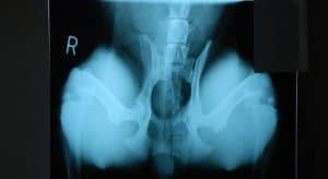 X-Ray photo of dog hips